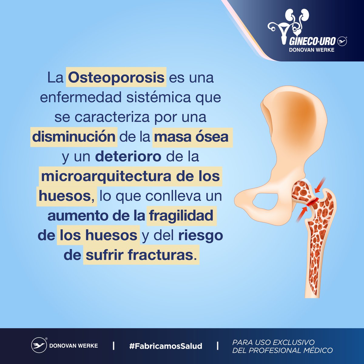👨‍⚕️¿Qué sabes sobre la Osteoporosis?
 #Salud #SaludPreventiva

@Donovan_Werke 
#FabricamosSalud