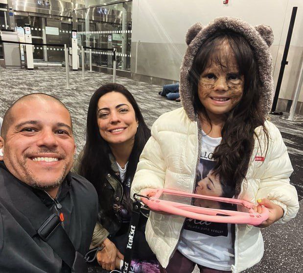 jaccocharite's tweet photo. 🏥 Luna Fenner from the USA returned to Russia to undergo a new operation.

Four years ago, Russian doctors were able to remove a huge birthmark from her face: in the United States the doctors refused to make this procedure.

Now St. Petersburg specialists will remove the 
1/ https://t.co/fWf1ifbW9B