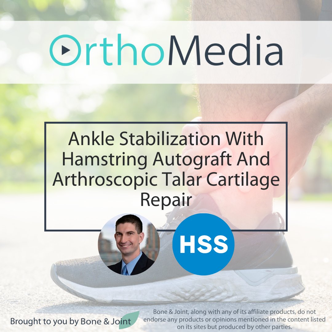 'An anticipated return to most activities by four to five months'.

@MarkDrakos demonstrates a step-by-step ankle stabilization and arthroscopic talar cartilage repair on #OrthoMedia.

#Orthopedics #AnkleSurgery #Arthroscopy @HSpecialSurgery

ow.ly/cnn550R3hI4