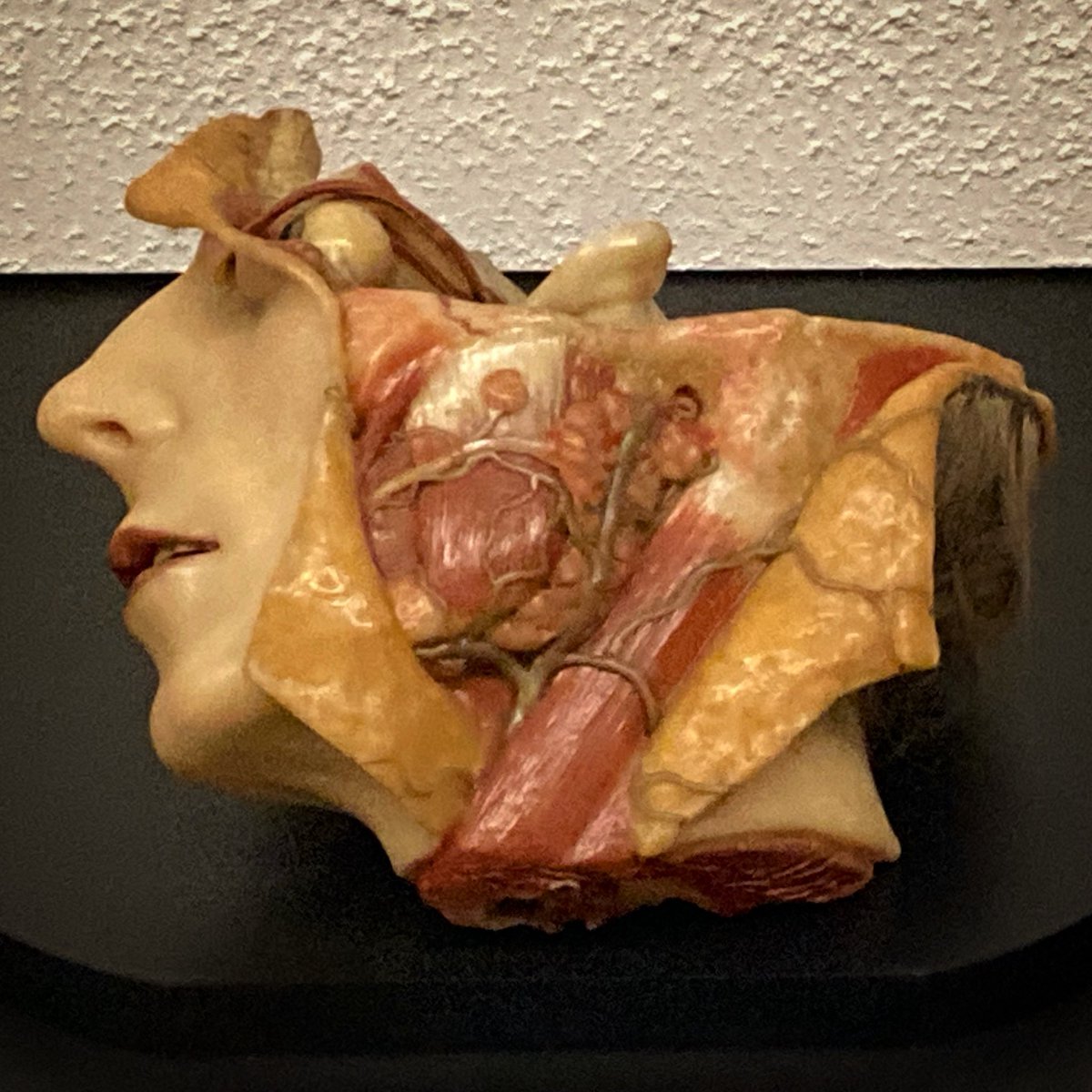 Wax model showing a dissection of the head.  Made in Germany in the nineteenth century, and now on display in the Science Museum, London