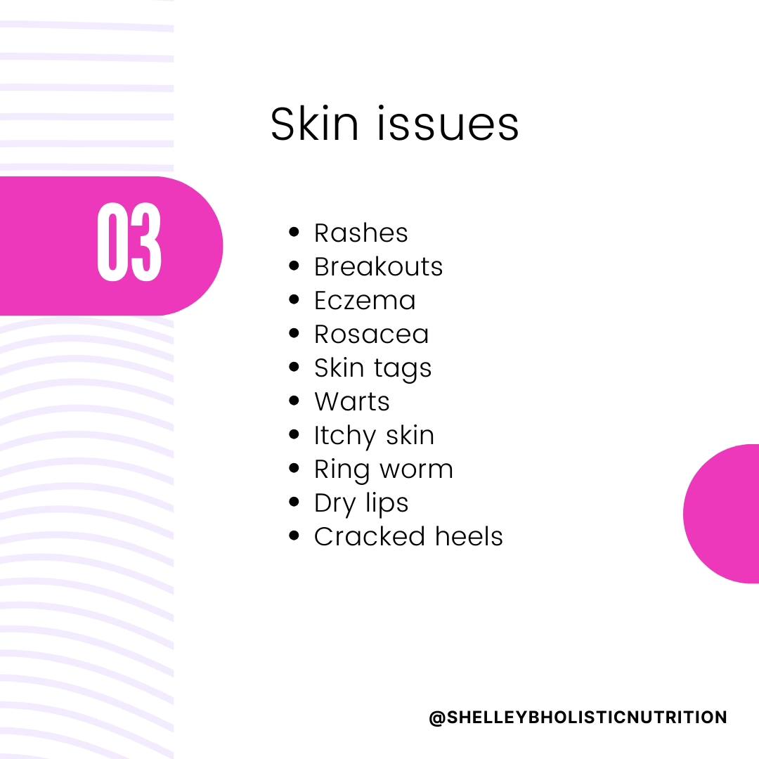 Many people associate symptoms of parasitic infection w digestive issues, nutrient deficiencies, emaciation & feeling hungry all the time. Bc there are a wide variety of parasites that can manifest all throughout the body & cause dysfunction, symptoms are actually wide-ranging.