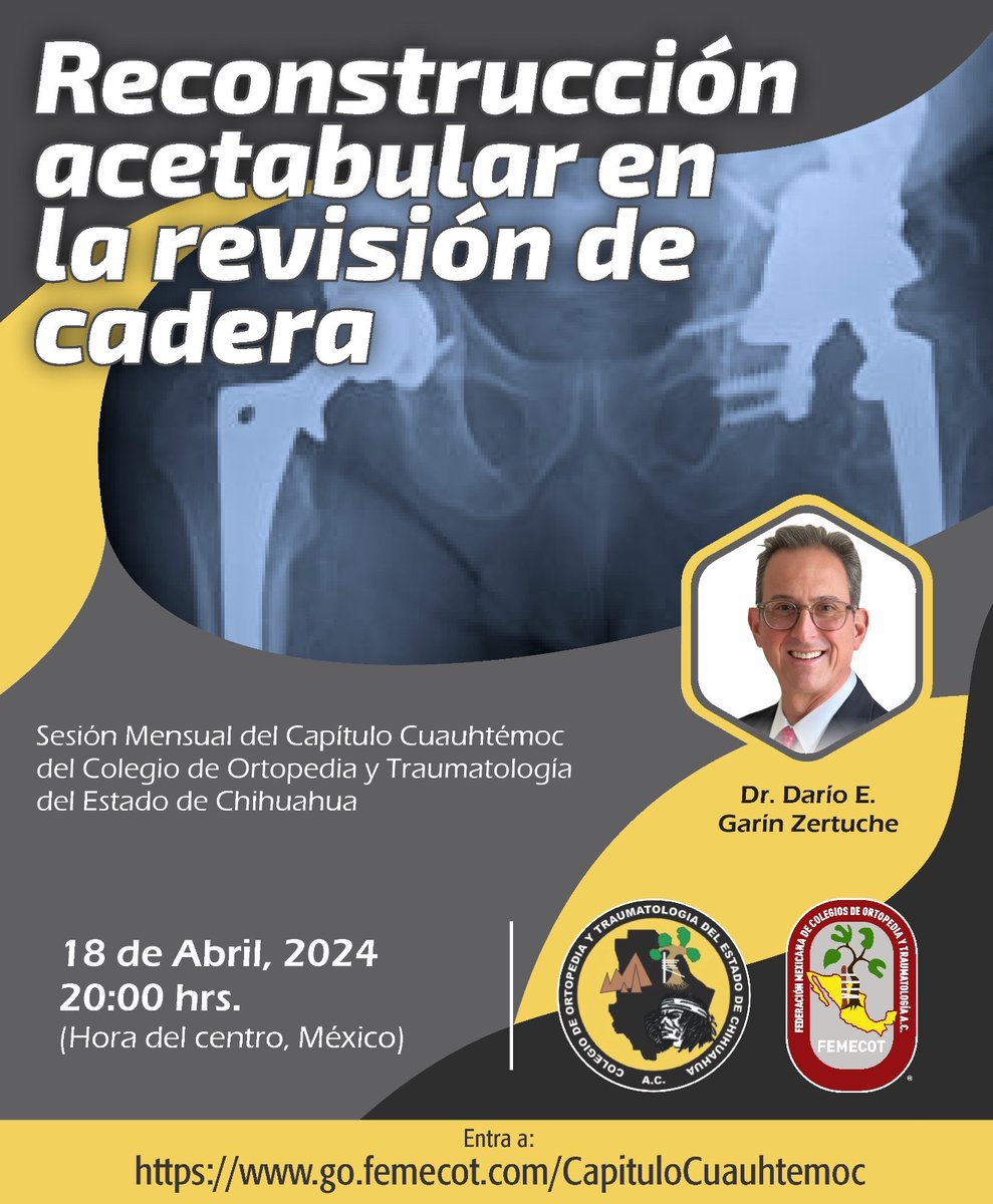 Reconstrucción acetabular en la revisión de cadera youtube.com/live/8xLYr1dUp… Sesión mensual del colegio del Capítulo Cuauhtémoc del Colegio de Ortopedia y Traumatología del Estado de Chihuahua 18 de Abril de 2024 20:00 hrs (Hora del centro, México)