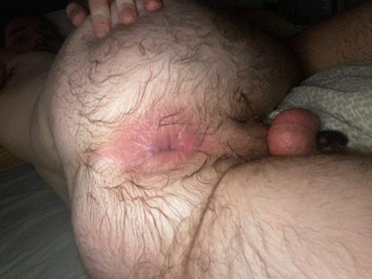Like a hairy used hole? 🕳️