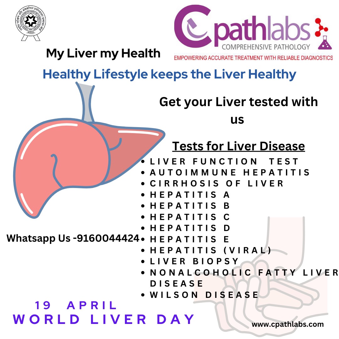 cpathlabs's tweet photo. The secret to vitality with a healthy lifestyle that nourishes your liver. Embrace wholesome nutrition, stay active, and cherish well-being. Your liver, your engine for a vibrant life.
#CpathLabs #HealthyLiver #Vitality
#WellnessJourney #LifestyleChoices
#LiverHealth https://t.co/o8ntYhNMzC