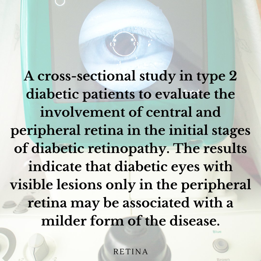 OPEN ACCESS Article
CENTRAL AND PERIPHERAL INVOLVEMENT OF THE RETINA IN THE INITIAL STAGES OF DIABETIC RETINOPATHY
Santos, Ana Rita PhD;  et. al. 
Retina 44(4):p 700-706, April 2024
journals.lww.com/retinajournal/…
#retina @AIBILI @diabeticretinopathy