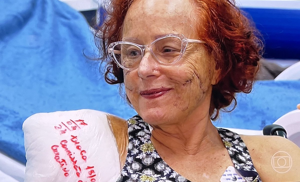 Vez por outra um ser de luz sofre uma violência inominável apenas p/nos ensinar a lidar c/a dor. Depois de perder um braço e uma orelha num ataque de pitbulls, a escritora Roseana Murray recebeu alta hoje do hospital impressionando a todos pela leveza, alegria e vontade de viver!