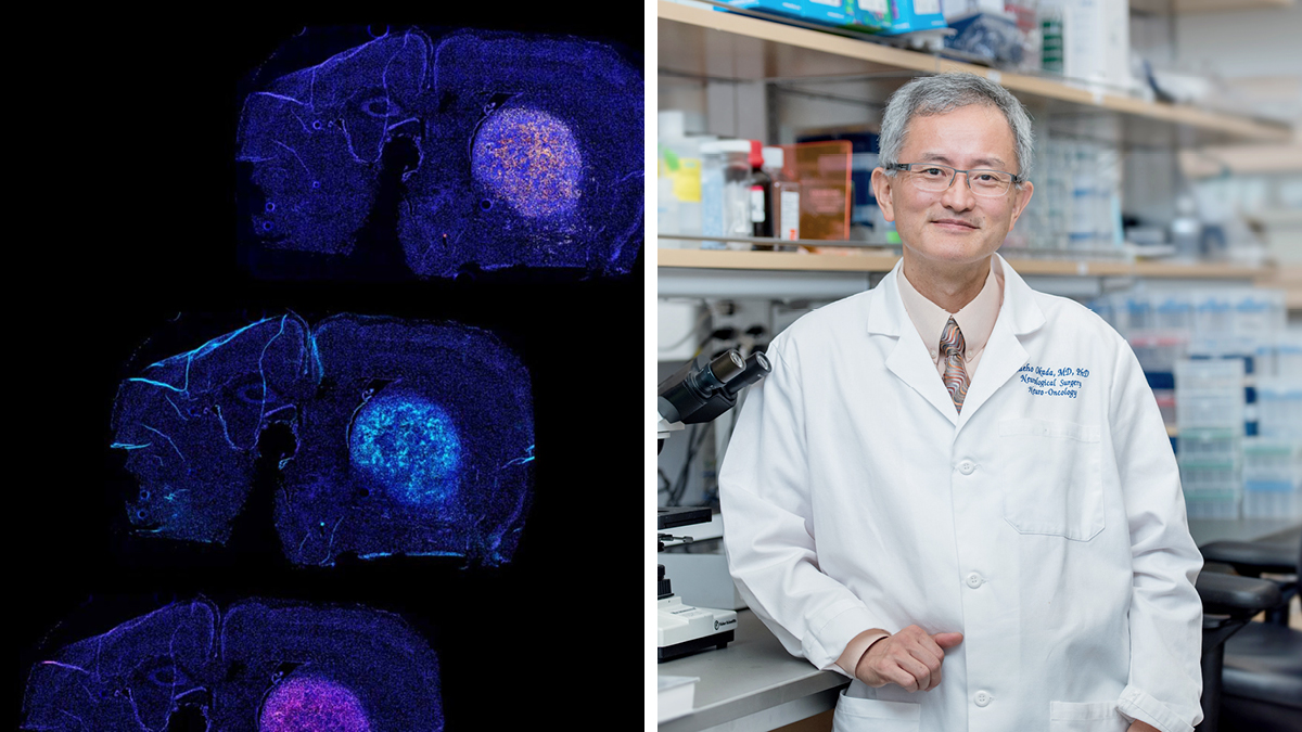 'This project is a prime example of bench-to-bed translation within UCSF, representing the strengths in basic and clinical science,' said Hideho Okada, MD, PhD. Read about the new @CIRMnews-funded synNotch #CART clinical trial for #GBM ➡️ucsf.edu/news/2024/04/4… @UCSFCancer @UCSF