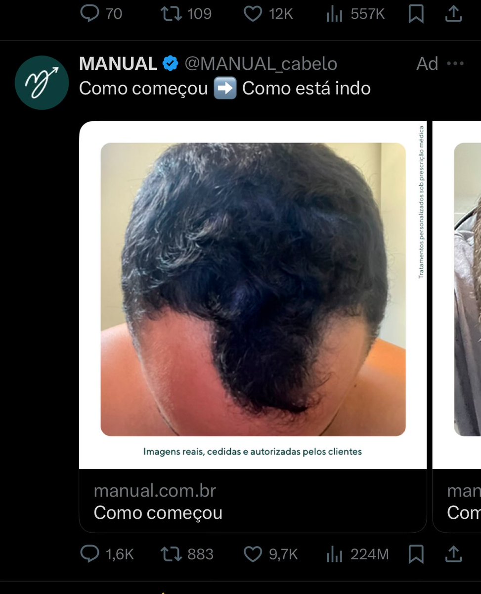 X quer me dizer alguma coisa???

Essa propaganda aparece em 1 de 3 post que eu abro, toda vez, desde janeirooookkk q ódio