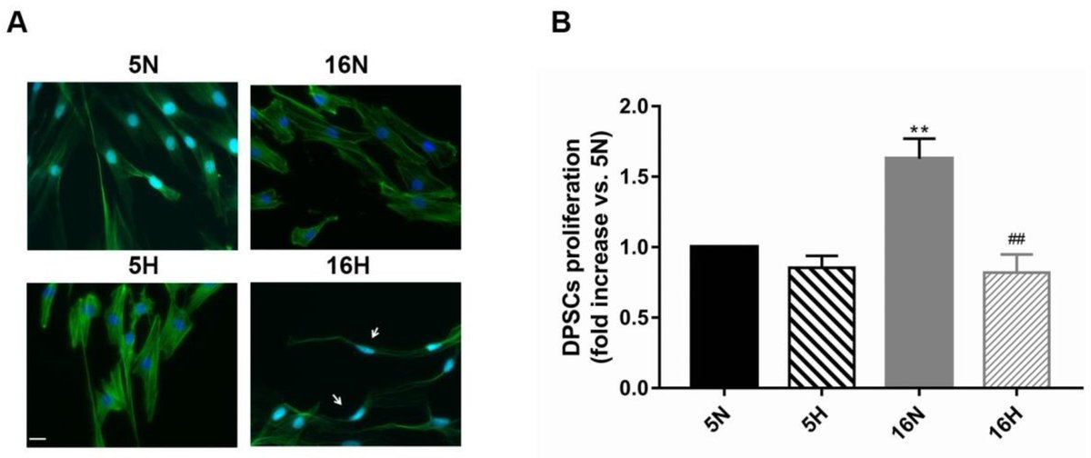 Biomed_MDPI's tweet photo. Hypoxia Induces #DPSC Differentiation versus a Neurogenic Phenotype by the Paracrine Mechanism
⤵️https://t.co/DYiOpJjI0h https://t.co/cv687x8AN9
