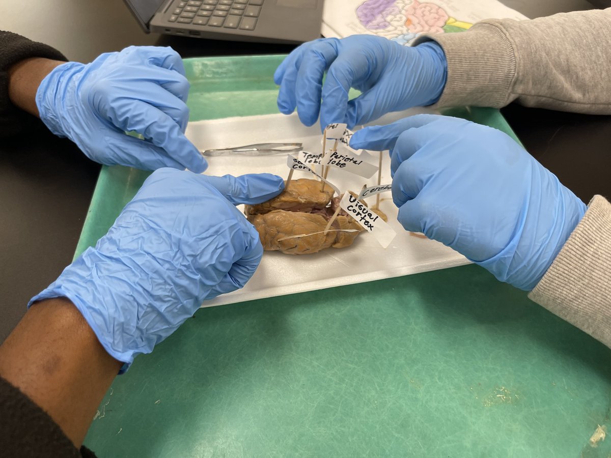 Today our PLTW Medical Detective students engaged in a sheep brain dissection. Together, we learned so much! I am so proud of our students and  so happy I was able to join them and their amazing teacher in this dissection. @LindberghStemLB #ProudtobeLBUSD #TogetherWeRise