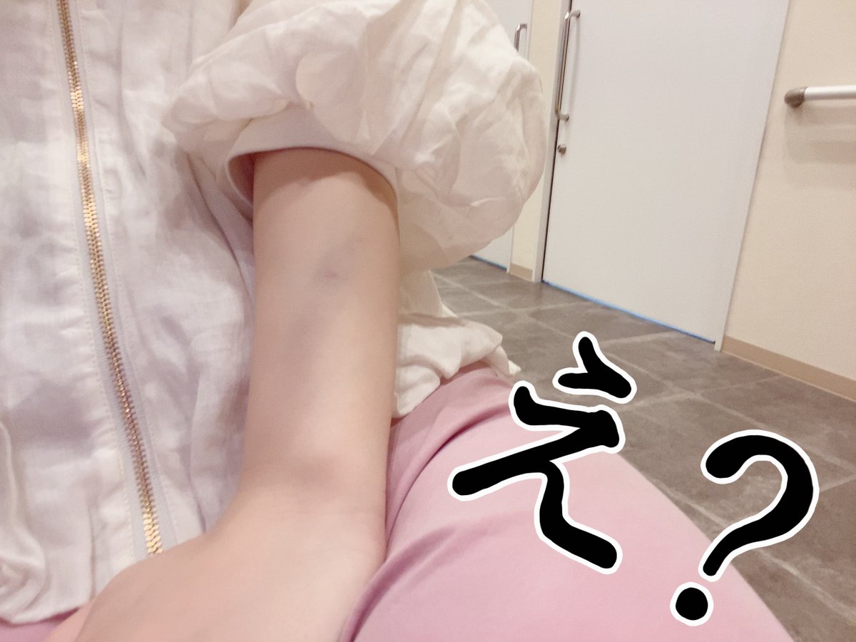 昨日電車のドアに挟まって痛かったにょーん
汚れついちゃったと思ったら、あざやったにょーん