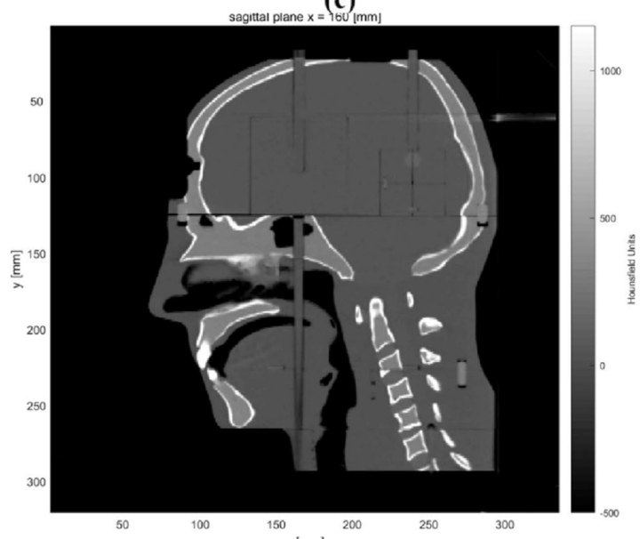 hafimoz's tweet photo. our research on #radiotherapy dosimetry has been published https://t.co/ZEcIsiGOYH with @SpringerNature #medicalphysics #patientsafety https://t.co/BZjmglGWz3