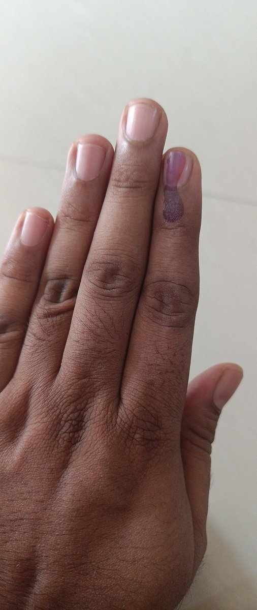 Casted my vote for you brother 💥

Hoping for you to WIN BIG 🔥 
My best wishes 🥳

#Vinoj4CentralChennai 
#TNElection 

#BJP4India 
#ModiAgain2024