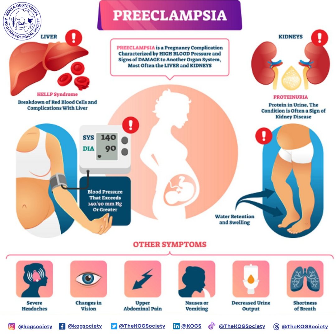 TheKOGSociety's tweet photo. Pre-eclampsia is a pregnancy complication characterized by high blood pressure and damage to organs, most commonly the liver and kidneys. It usually occurs after 20 weeks of pregnancy and can lead to serious complications for both the mother and baby if left untreated. #KOGSNawe https://t.co/LqiF5jbOJI