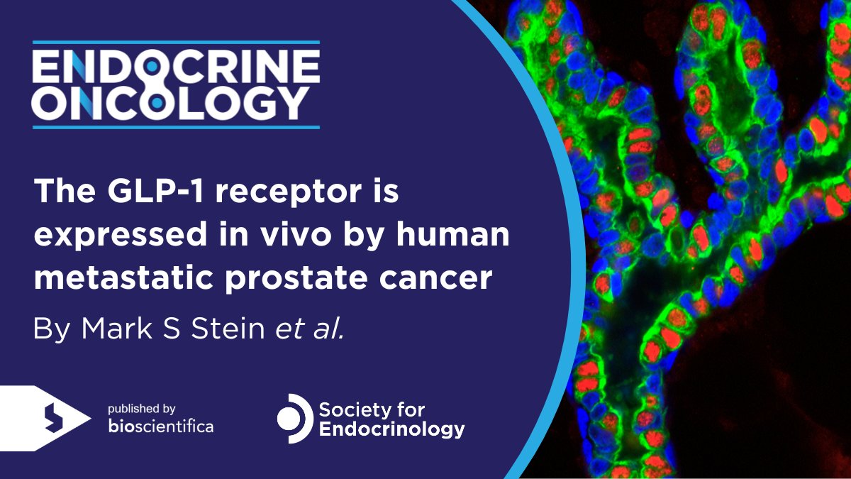 Discover this research by Mark S Stein et al. demonstrating in vivo glucagon-like peptide-1 receptor (GLP-1R) expression by human metastatic castrate-resistant #prostate #cancer👉 ow.ly/eO8850Rj7RX @DrMHofman