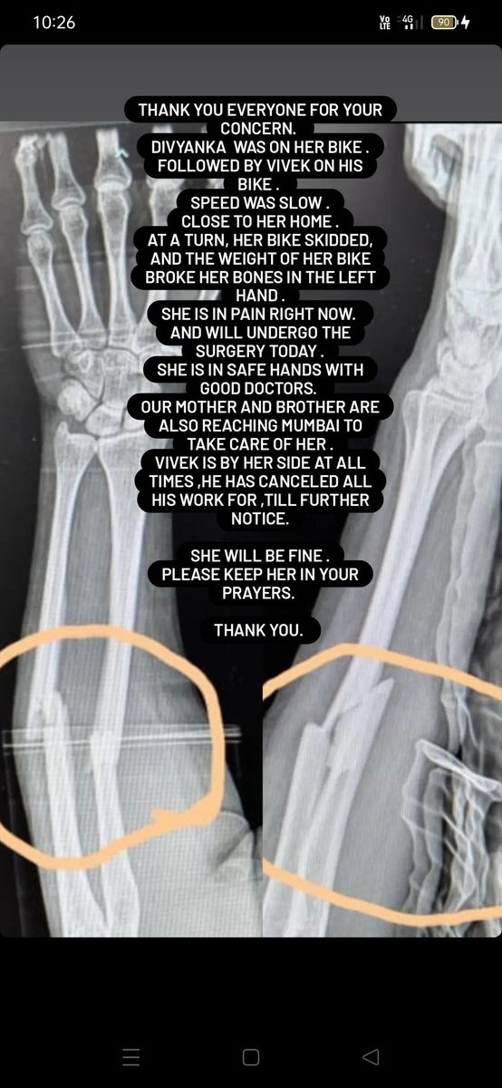 Guys, we have an update! Priyanka Di ( Divyanka's elder sister) has updated about the whole accident.
#DivyankaTripathi 
Please keep her in your Prayers!🙏