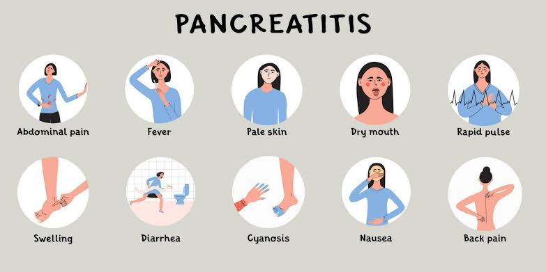 Pancreatitis is inflammation of the pancreas. Inflammation is immune system activity that can cause swelling, pain, and changes in how an organ or tissues work.

The pancreas is a long, flat gland that's tucked behind the stomach. The pancreas helps the body digest food and