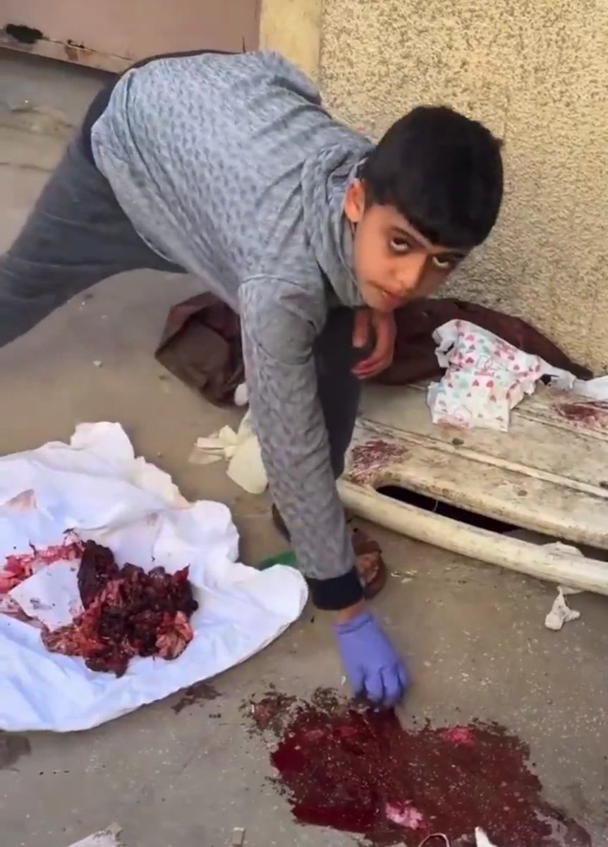 🚨🇮🇱🇮🇷 ISRAEL is making children clean up the remains of their mother — but the US only CONDEMNS IRAN!