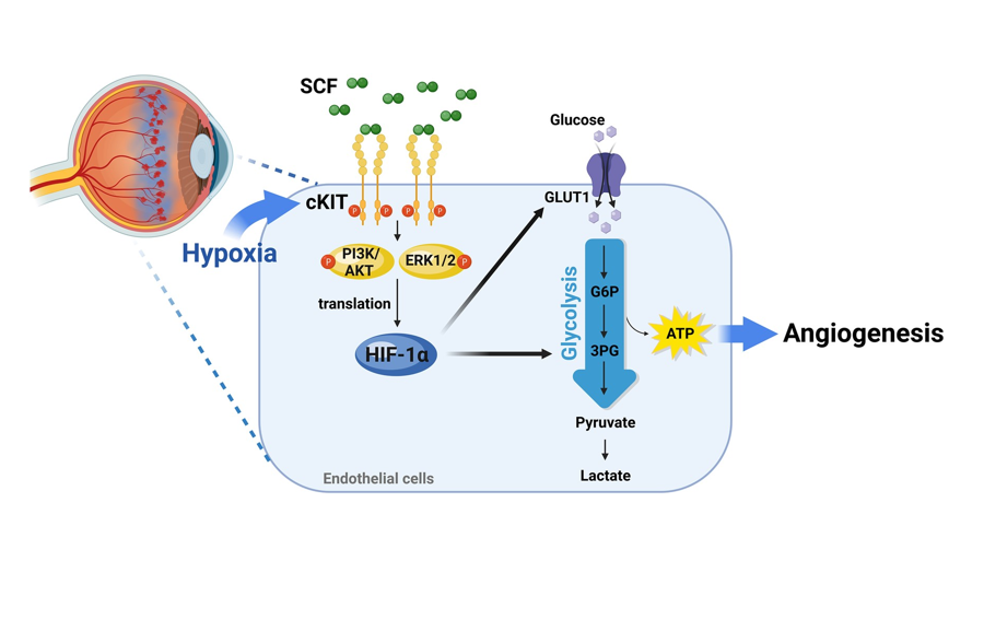 ESC_Journals's tweet photo. Feeding #angiogenesis with #cKit
New #CardiovascularResearch study identifies the SCF/cKIT/HIF-1α axis as a potential therapeutic target for pathological neovascularization
https://t.co/n9wZxVZmv0
@CVR_TomaszGuzik @glenpyle @DrMikeDrozd #hypoxia #CardioX https://t.co/wumQJgCOtu