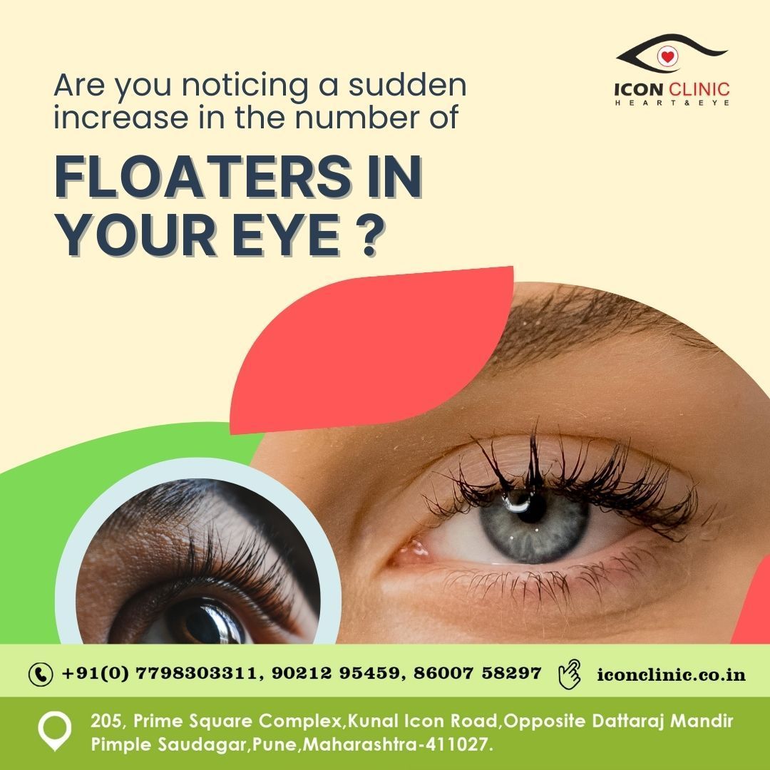 The sudden increase in eye floaters? Don't wait!
See an eye doctor right away. It could be a sign of a serious condition. Schedule an appointment at Icon Eye Clinic today!
#EyeHealthMatters #EyeHealthAwareness #FloatersInVision #EyeHealthTips #Optometry #RetinaHealth #Vision