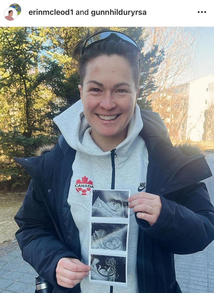 Huge congratulations to @erinmcleod18 and her wife for announcing their pregnancy! 🫄 ❤️