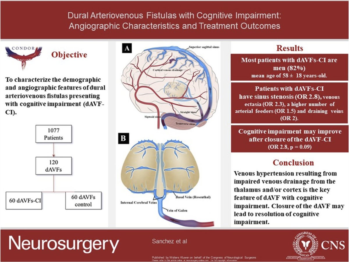 #NEUVisualAbstract Dural Arteriovenous Fistulas With Cognitive Impairment: Angiographic Characteristics and Treatment Outcomes bit.ly/4aCOTVO by @ssanchezneuro et al @IowaNeurology @DKondziolkaCNS @CNS_Update @jmascite @LKReedMD @AliAlawiehmdphd