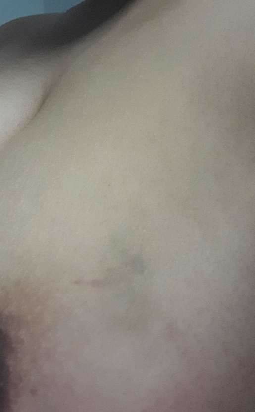 أثار افتراس