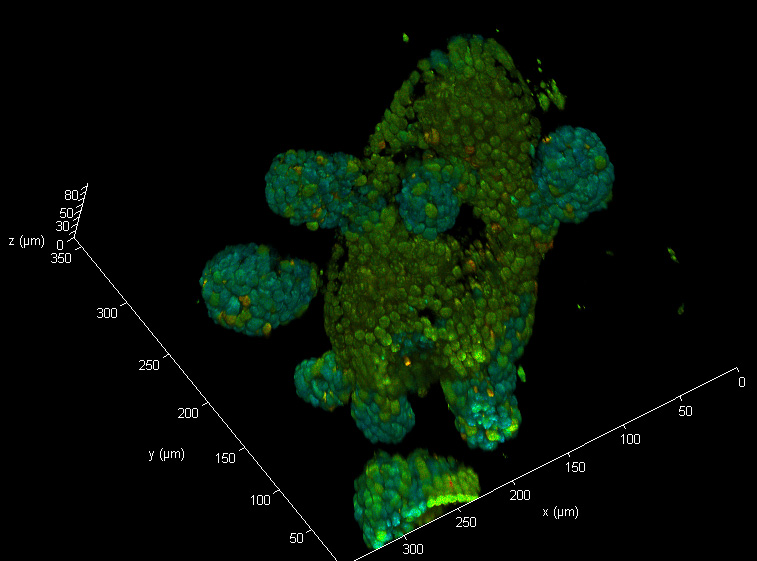 Truly #fluorescencefriday with great news that @FWOVlaanderen has approved our #Hercules #Mediumsize research infrastructure grant funding #twophoton #flim upgrade @ugent_fge #theCore @ResearchUGent and @microscopyUGent ! Thanks&congrats to all including @FlImagin3_DN