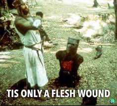 ‘Tis only a flesh wound and one of Sunak’s professionals has assessed you fit to work. #SunakOut