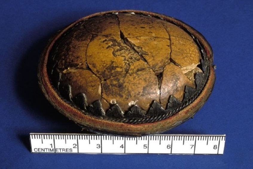 This bladder stone was 'cut by Jer. Callot from Thomas Murray at Paris, 8th May 1676' Removing bladder stones was very dangerous as surgeons had to cut into the perineum and then into the bladder. Survivors often kept the stone as a memento like this one.