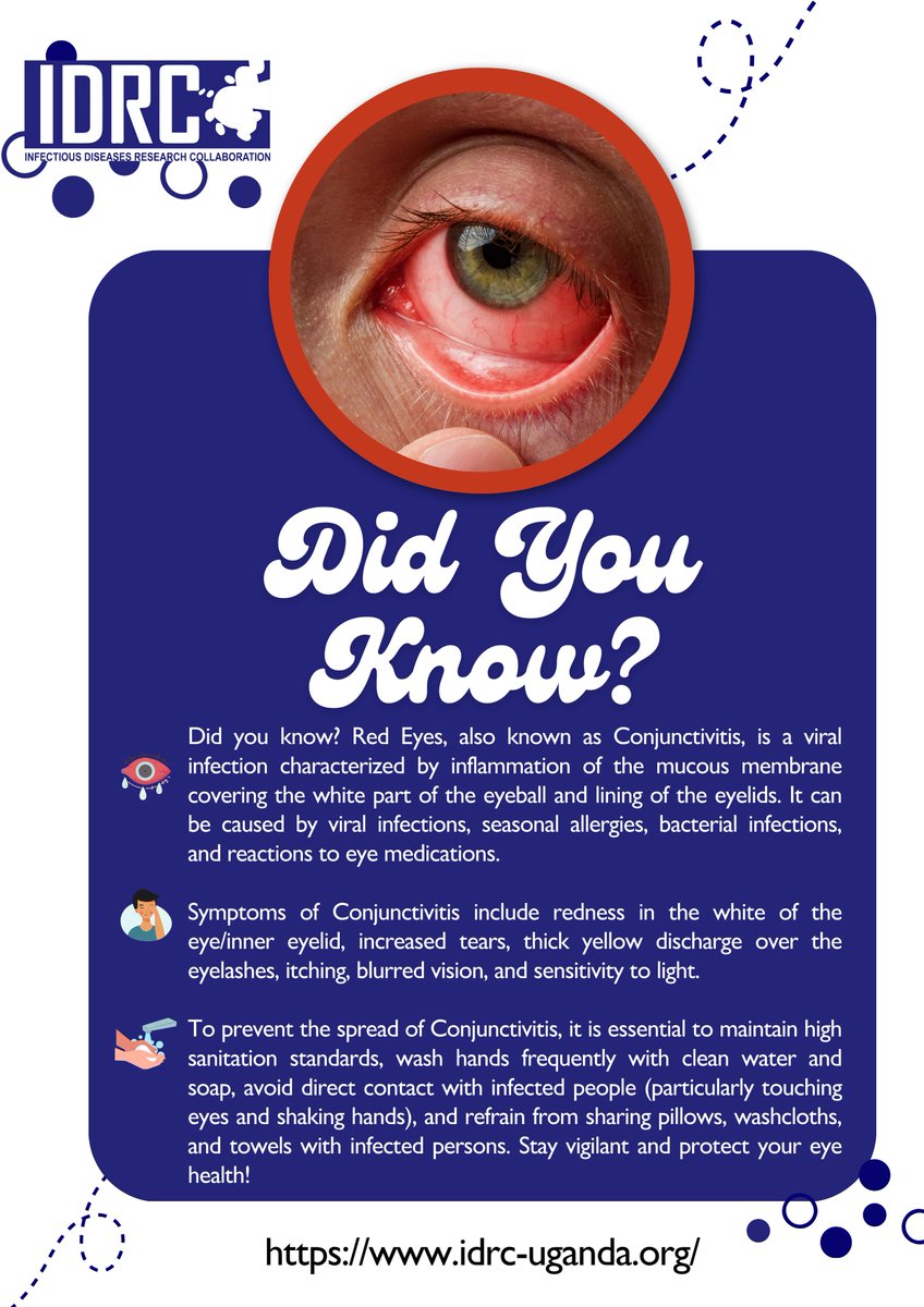 Did You Know? Red eye can be more than just a simple irritation - it can be a sign of a serious condition. Stay informed on symptoms and prevention strategies. #EyeHealth #redeye #didyouknow