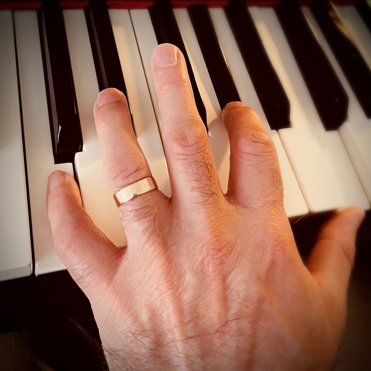 After dislocating my little finger last month I'm finally back to playing the piano (somewhat tentatively). Still experiencing some soreness and swelling but after weeks of strapping and physiotherapy progress is good. 👍