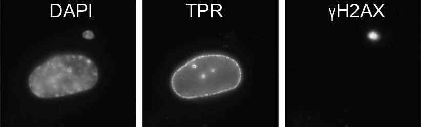 Lovely work from @beth_bartlett showing the role of the nuclear pore basket in formation of cytoplasmic chromatin fragments & activation of innate immune sensing in senescence. biorxiv.org/content/10.110…
@mrc_hgu @EdinUni_IGC @jucaacoco