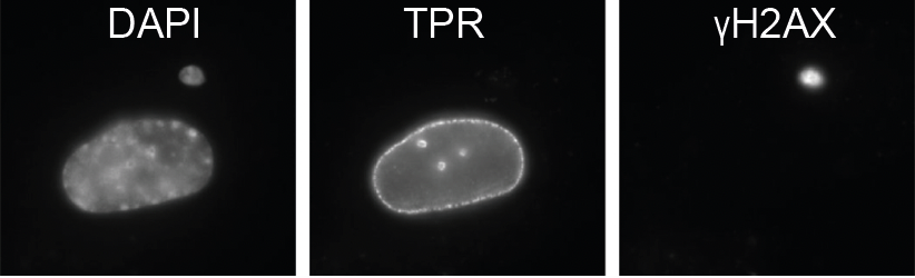 Wendy Bickmore (@wendy_bickmore) on Twitter photo Lovely work from <a href="/beth_bartlett/">Bethany Bartlett</a> showing the role of the nuclear pore basket in formation of cytoplasmic chromatin fragments & activation of innate immune sensing in senescence. biorxiv.org/content/10.110…
<a href="/mrc_hgu/">MRC_HGU</a> <a href="/EdinUni_IGC/">Institute of Genetics and Cancer</a> <a href="/jucaacoco/">Juan Carlos Acosta</a> Lovely work from <a href="/beth_bartlett/">Bethany Bartlett</a> showing the role of the nuclear pore basket in formation of cytoplasmic chromatin fragments & activation of innate immune sensing in senescence. biorxiv.org/content/10.110…
<a href="/mrc_hgu/">MRC_HGU</a> <a href="/EdinUni_IGC/">Institute of Genetics and Cancer</a> <a href="/jucaacoco/">Juan Carlos Acosta</a>