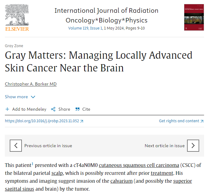 ☢️@MSKCancerCenter skin cancer expert Dr Christopher A. Barker weighs in on a @IJROBP #GrayZone case of a patient with a cT4aN0M0 cutaneous squamous cell carcinoma of the bilateral parietal scalp, which is possibly recurrent after prior treatment. sciencedirect.com/science/articl…