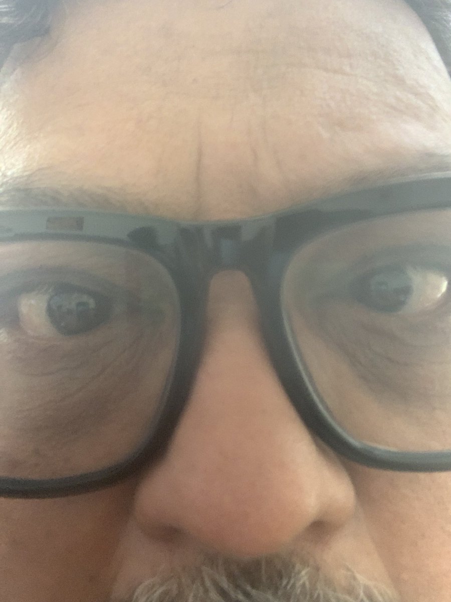 Just saying !!!

For the @arts_dao fest, I have been on @TwitterMENA for so long that my eyes have become like this. 

Tomorrow I am convinced it would align to see the OG Degens at the Fest. 

But till then deal with this