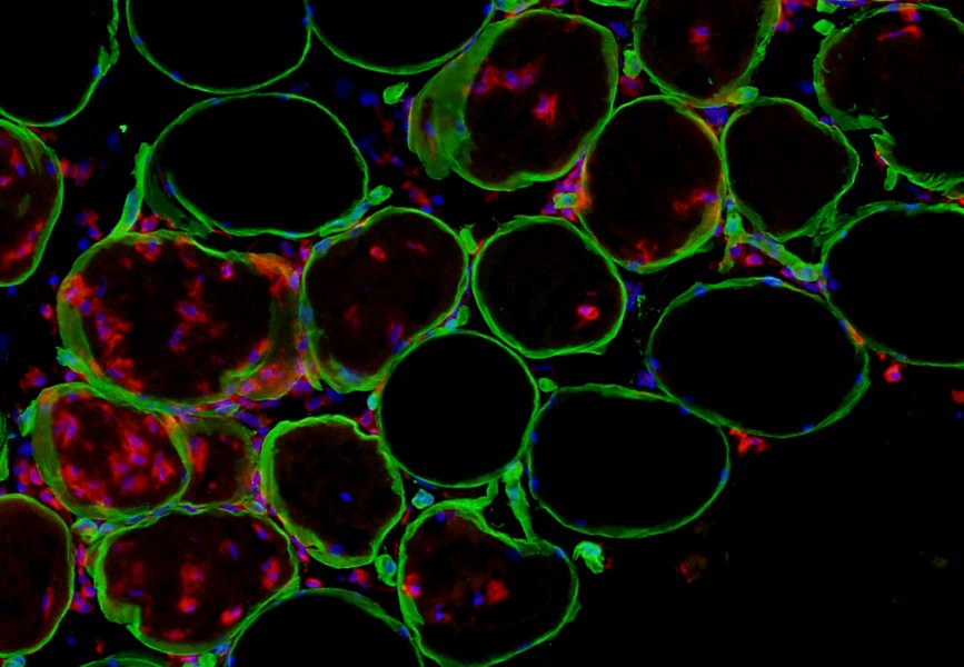 Happy #fluorescencefriday 
myofiber macrophage (CD68) infiltration