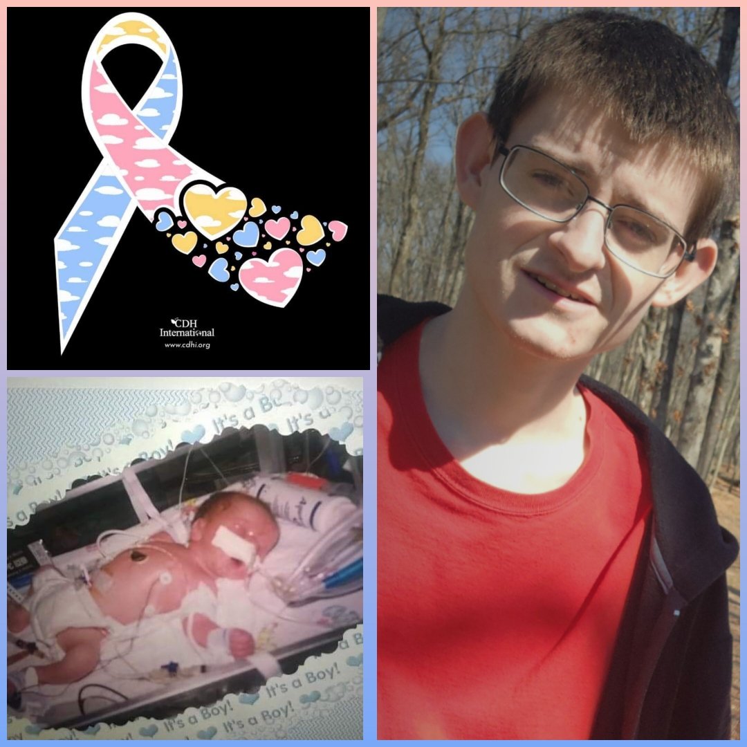 20% chance of survival, he'll be 26 in May 🩷💛🩵
#CDHAwarenessMonth #cdh #CDHwarrior #cdhsurvivor #CDHAwarenessDay #April19 #pinkyellowblue #cdhawareness #CongenitalDiaphragmaticHernia #rcdh