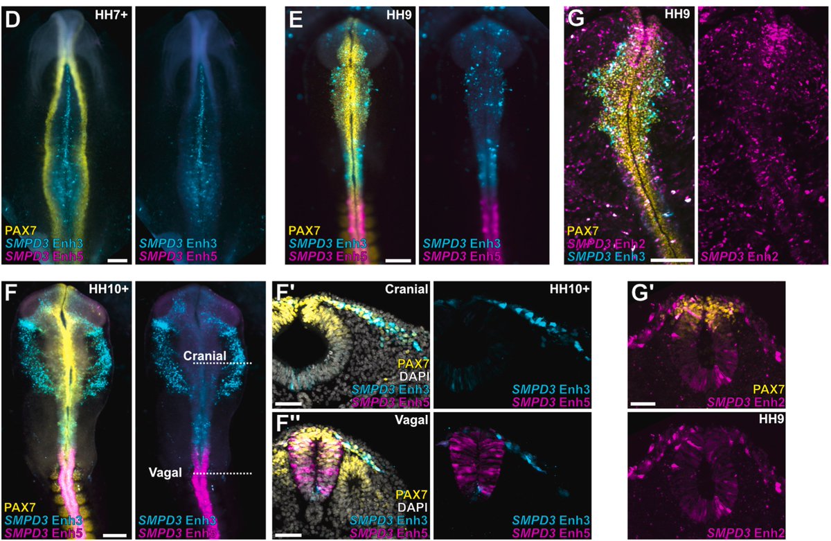 Developmental Biology (@dev_bio_journal) on Twitter photo #DBfeature #NeuralCrest🐣
SMPD3 expression is spatially regulated in the developing embryo by SOXE factors
by Michael Piacentino et al <a href="/MikePiacentino/">Mike Piacentino</a>
sciencedirect.com/science/articl… #DBfeature #NeuralCrest🐣
SMPD3 expression is spatially regulated in the developing embryo by SOXE factors
by Michael Piacentino et al <a href="/MikePiacentino/">Mike Piacentino</a>
sciencedirect.com/science/articl…