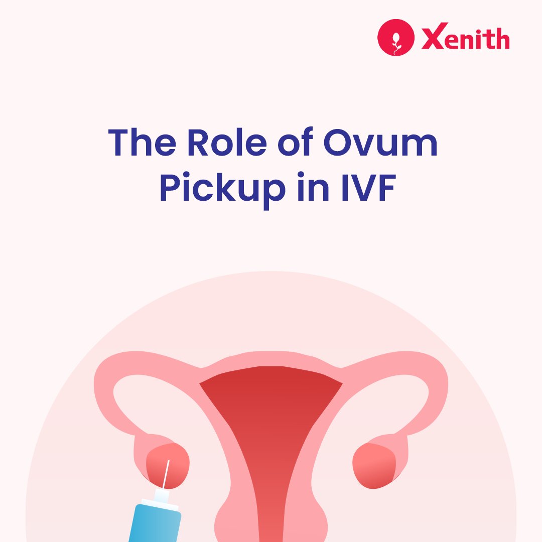 xenithivf's tweet photo. Ovum pickup is a delicate process that plays a pivotal role in the IVF process. 

For more information, visit our blog
https://t.co/zRStZsDKOM

Call us on 📞+91-9172318664 / +91-9130776776 to book your consultation today and know more

#IVF #ovumpickup #Xenith #blogs https://t.co/nwhUbgeuUv