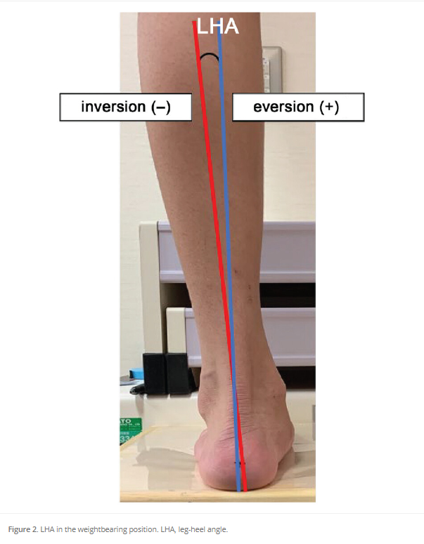 Is foot alignment or postural stability associated with chronic ankle instability? This Japanese study looks at this relationship in adolescent athletes. #ankleinstability #anklesprain #brostrum #OrthoTwitter See the results #OpenAccess here: ow.ly/1XJS50RhCuj