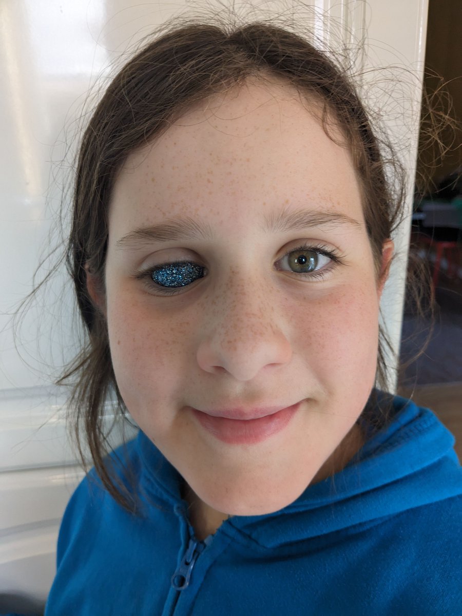 How cool does Ivy look?! After losing her eye to retinoblastoma, Ivy was inspired by reading other stories shared with CHECT to express her individuality and get a sparkly blue eye: buff.ly/49Z4X3j