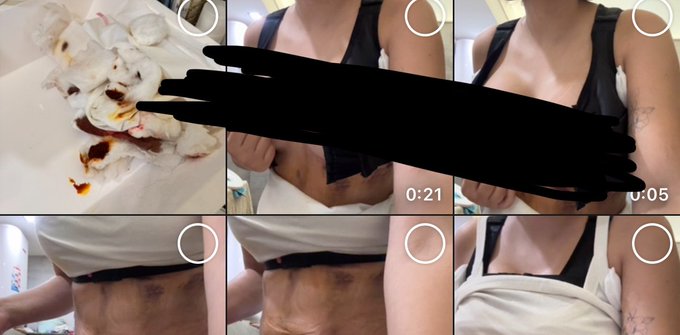 My phone gallery right now&hellip; 🫠 https://t.co/SPhNSv0RQk