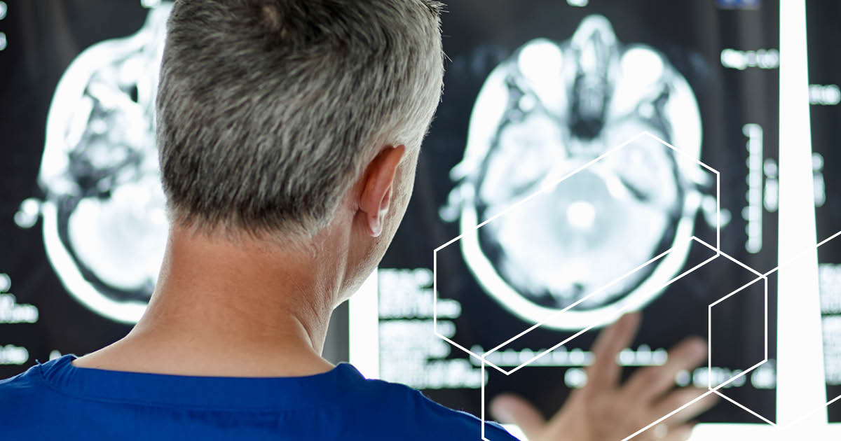 Exablate Neuro uses focused ultrasound to zap tremors and stiffness related to #Parkinson’s. Can non-invasive tech revolutionize treatment? ow.ly/j8IZ50QoX0I #CASInsights #emergingtrends #2024trends