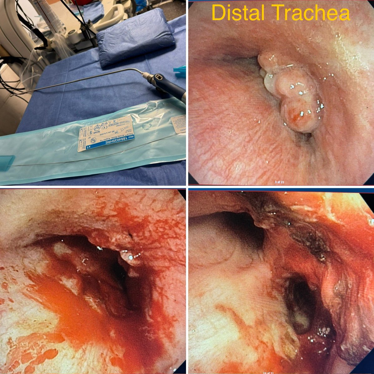 Ali Abedi MD FCCP DAABIP tweet media