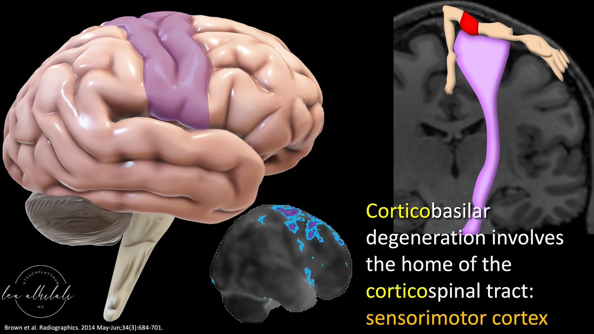 Lea Alhilali, MD tweet media