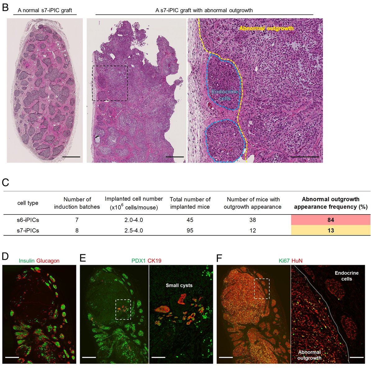 PancreaticCell's tweet photo. 📢 New in @PNASNews!
Researchers led by Dr. Taro Toyoda at @KyotoU_News have shown that the implantation of iPSC-derived pancreatic #IsletCells leads to the emergence of unexpected off-target cells with proliferative capacity via in vivo maturation.
https://t.co/LUDTJohmqB https://t.co/YKe6PMpN67