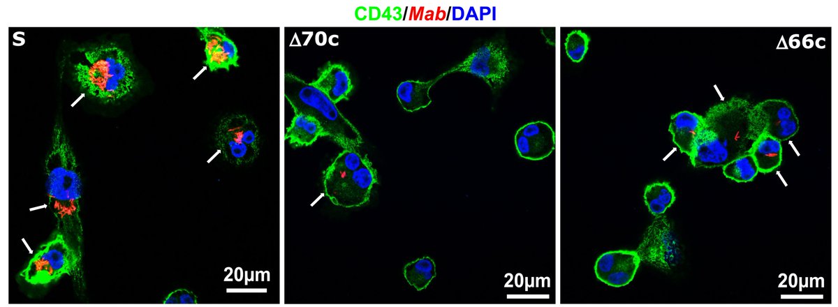 Now out as an Observation in <a href="/JournalSpectrum/">Microbiology Spectrum</a>! Loss of LpqM lipoproteins in Mycobacterium abscessus is associated with impaired intramacrophage survival by <a href="/YmBdh/">Yves-Marie Boudehen</a>, W. Daher and F. Roquet-Baneres <a href="/IRIM_life/">IRIM</a>.
doi.org/10.1128/spectr…