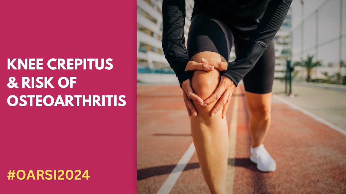 Knee crepitus, the audible crackling noise during knee movement, is present in 41% of the population. #ArthritisResearch found the presence of knee crepitus increased the odds of a diagnosis of #Osteoarthritis #OARSI2024 Learn more ow.ly/5XZi50RjrfO @jwhittak_physio