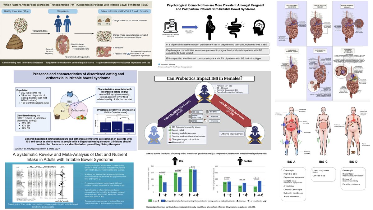 #IBSAwarenessMonth‼️
🚨Recent Highlights on #IBS articles @NGMJournal 2024🔥 #DiveDeep⏬
@maura_corsetti @IBS_Maastricht #FrankZerbib #KirsteenBrowning @DrCJBlack @AndreaShin_GI @mpj61 #FievosChristofi @VorkLisa @ThisIsButt @Pierfra_Visaggi @Rajan___Singh 
@ANMSociety @esnm_eu 👏